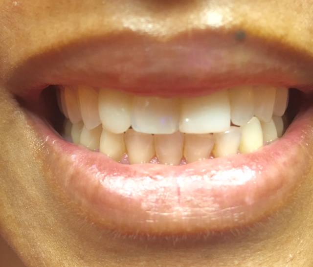 Mosaic dental center orlando florida