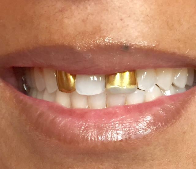 Mosaic dental center orlando florida