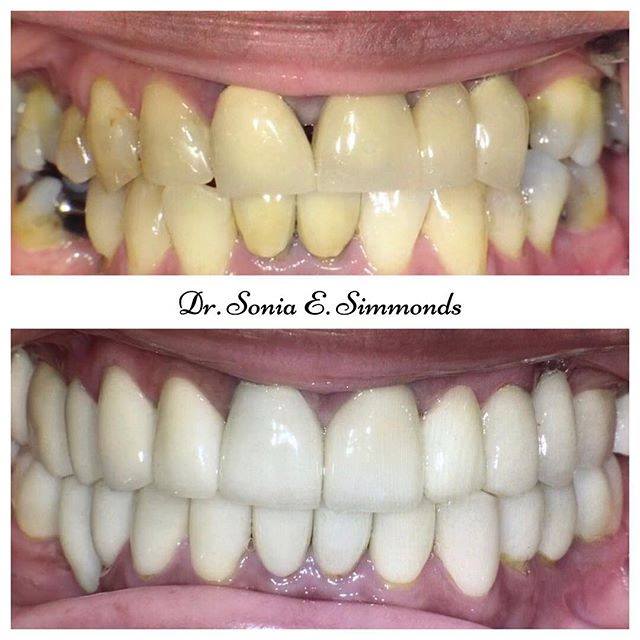 Mosaic dental center orlando florida