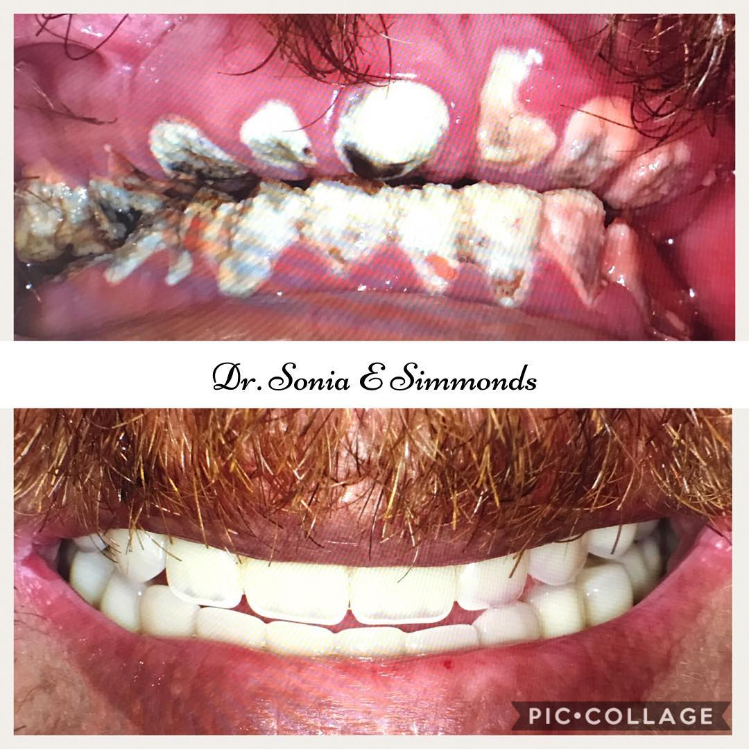 Mosaic dental center orlando florida