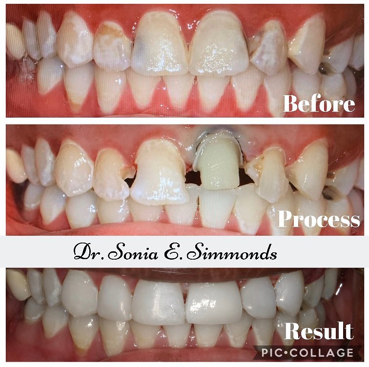 Mosaic dental center orlando florida