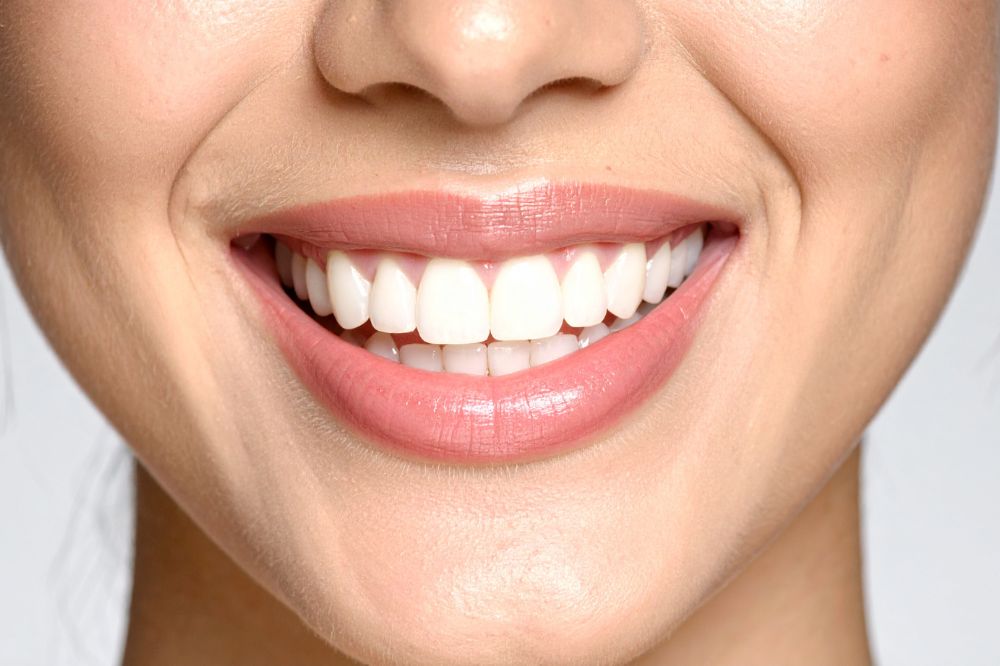 Teeth whitening safe options for a brighter confident smile
